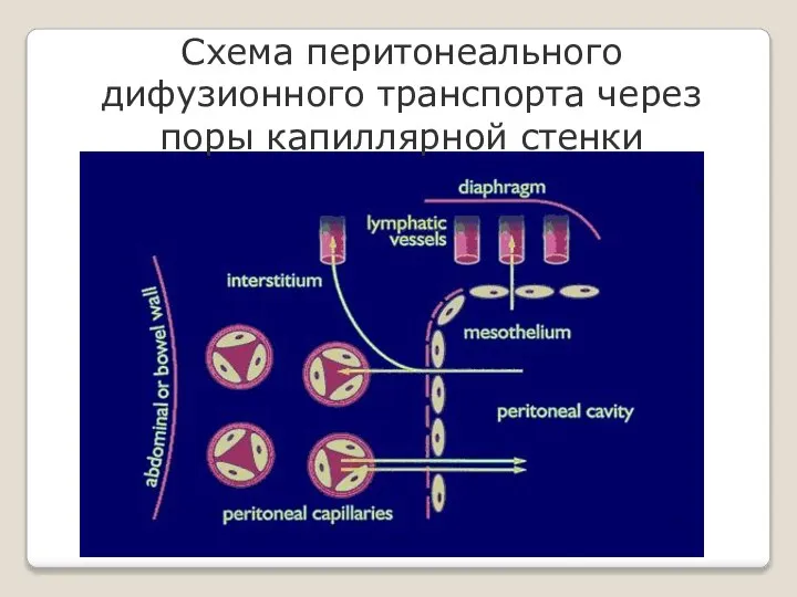 Схема перитонеального дифузионного транспорта через поры капиллярной стенки