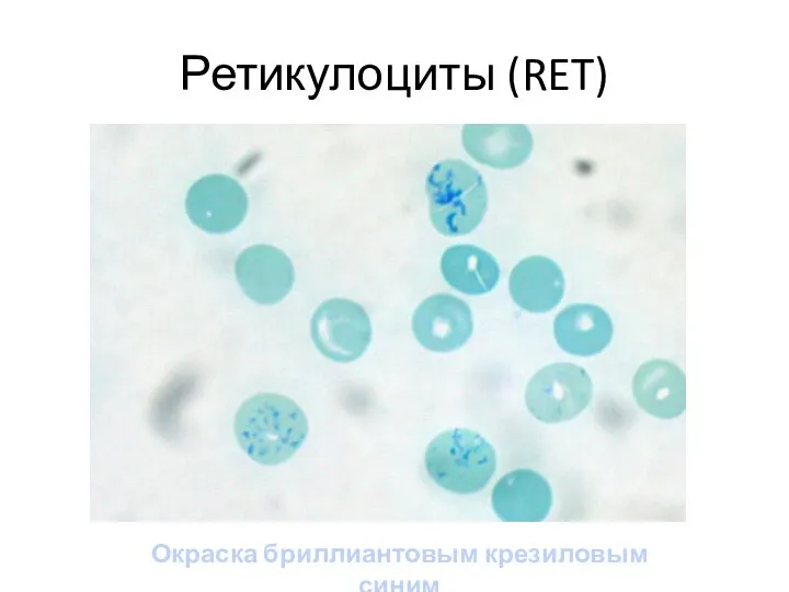 Ретикулоциты (RET) Окраска бриллиантовым крезиловым синим