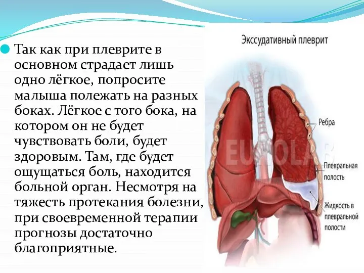 Так как при плеврите в основном страдает лишь одно лёгкое, попросите малыша