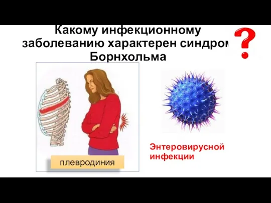 Какому инфекционному заболеванию характерен синдром Борнхольма Энтеровирусной инфекции плевродиния