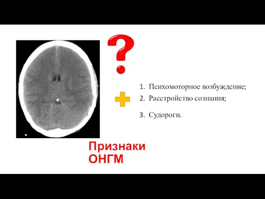 Признаки ОНГМ Психомоторное возбуждение; Расстройство сознания; Судороги.