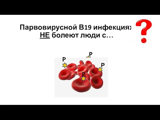 Парвовирусной В19 инфекциях НЕ болеют люди с… Р