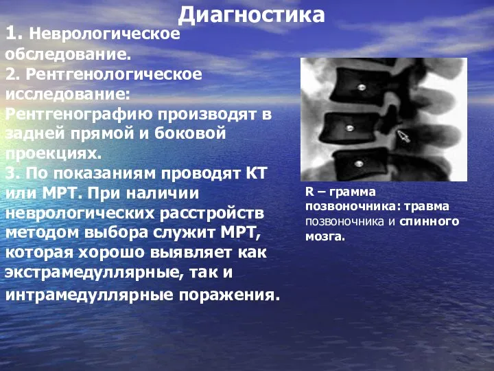 1. Неврологическое обследование. 2. Рентгенологическое исследование: Рентгенографию производят в задней прямой и