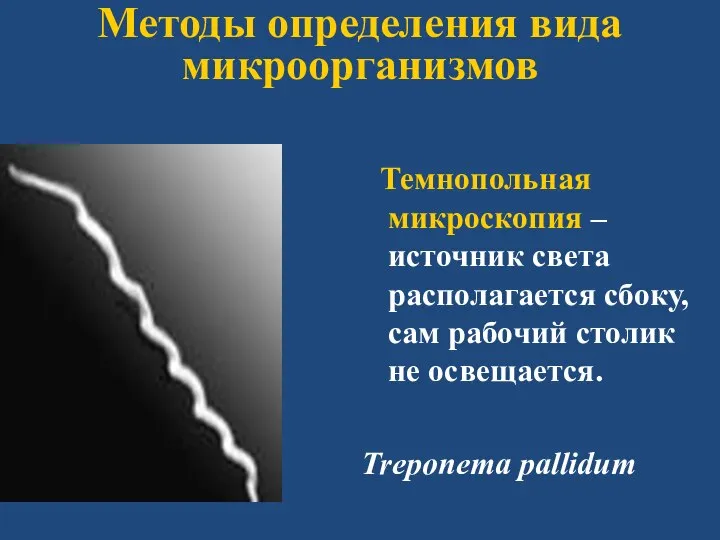 Методы определения вида микроорганизмов Темнопольная микроскопия – источник света располагается сбоку, сам