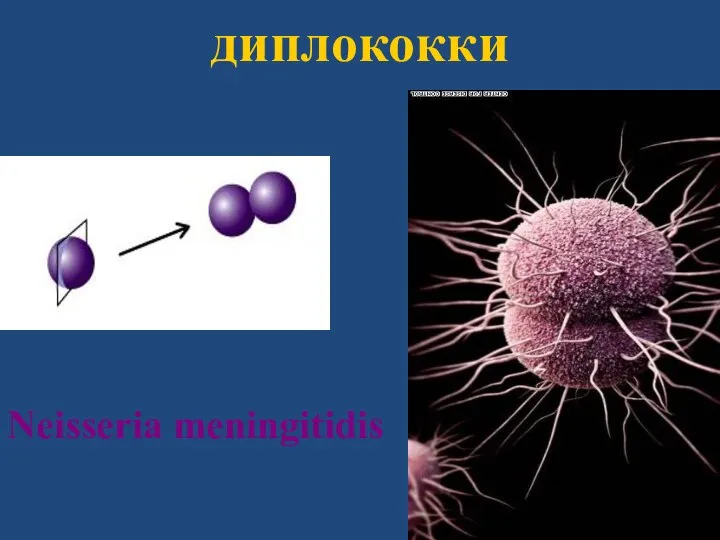 диплококки Neisseria meningitidis