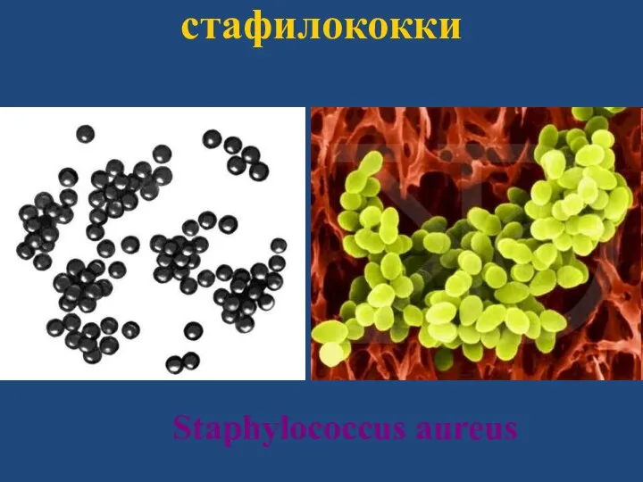стафилококки Staphylococcus aureus