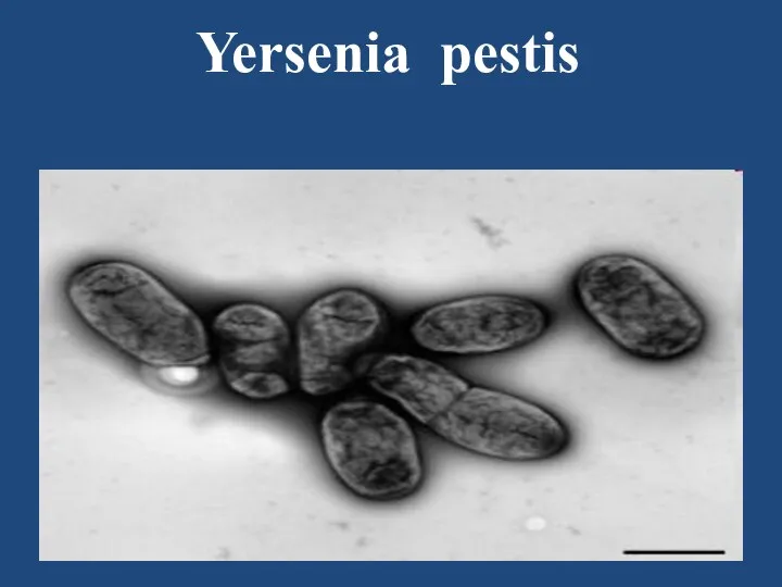 Yersenia pestis