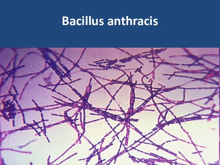 Bacillus anthracis