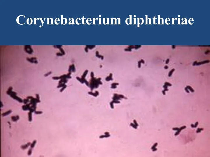 Corynebacterium diphtheriae