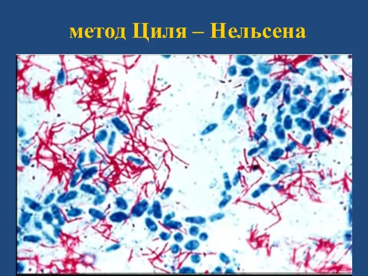 метод Циля – Нельсена