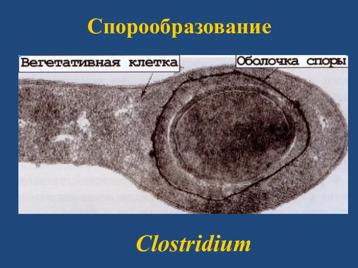 Спорообразование Clostridium