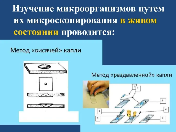 Изучение микроорганизмов путем их микроскопирования в живом состоянии проводится: