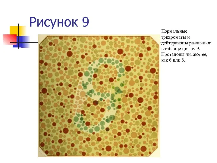 Рисунок 9 Нормальные трихроматы и дейтеранопы различают в таблице цифру 9. Протанопы