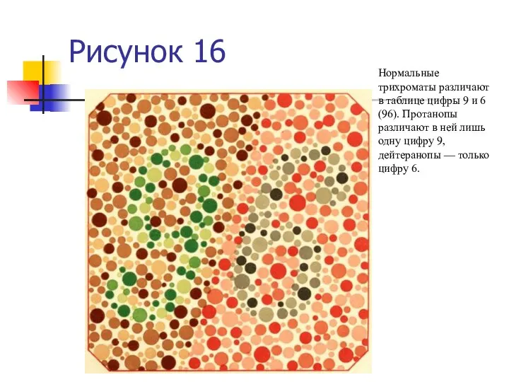 Рисунок 16 Нормальные трихроматы различают в таблице цифры 9 и 6 (96).