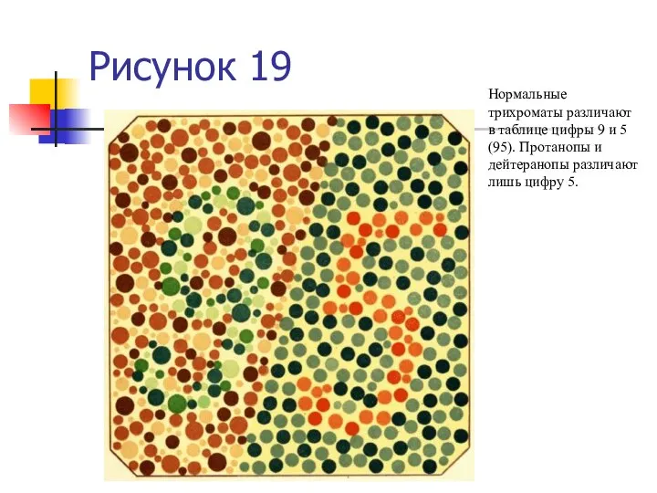 Рисунок 19 Нормальные трихроматы различают в таблице цифры 9 и 5 (95).