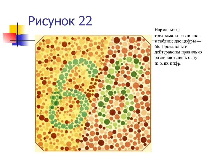 Рисунок 22 Нормальные трихроматы различают в таблице две цифры — 66. Протанопы