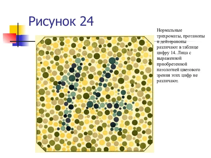 Рисунок 24 Нормальные трихроматы, протанопы и дейтеранопы различают в таблице цифру 14.