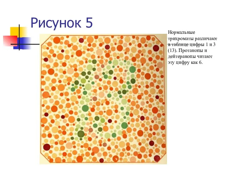 Рисунок 5 Нормальные трихроматы различают в таблице цифры 1 и 3 (13).