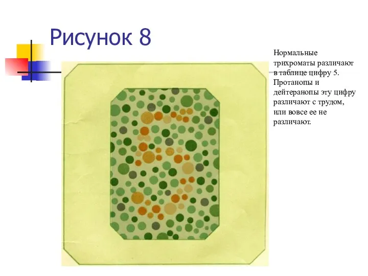 Рисунок 8 Нормальные трихроматы различают в таблице цифру 5. Протанопы и дейтеранопы