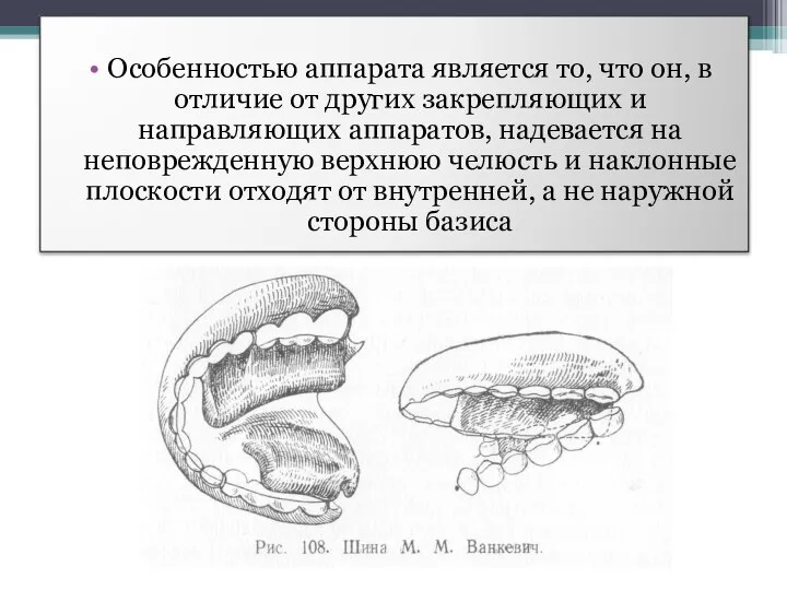 Особенностью аппарата является то, что он, в отличие от других закрепляющих и