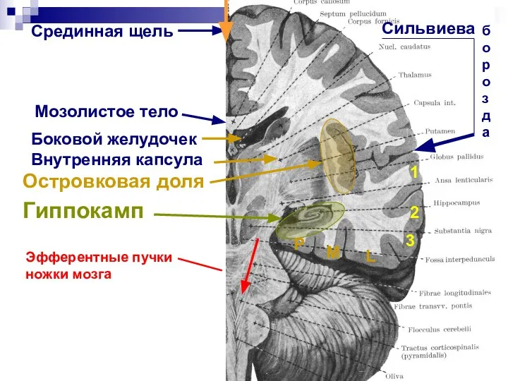 Срединная щель Мозолистое тело Боковой желудочек Внутренняя капсула Островковая доля Гиппокамп Сильвиева