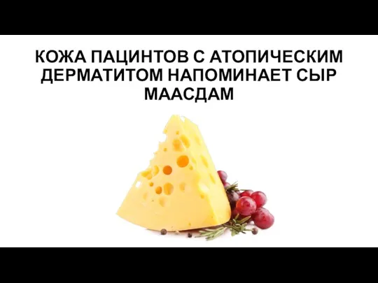 КОЖА ПАЦИНТОВ С АТОПИЧЕСКИМ ДЕРМАТИТОМ НАПОМИНАЕТ СЫР МААСДАМ