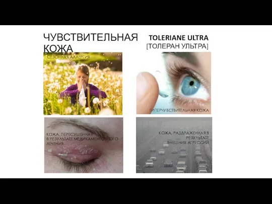 ЧУВСТВИТЕЛЬНАЯ КОЖА TOLERIANE ULTRA [ТОЛЕРАН УЛЬТРА] КОЖА, ПЕРЕСУШЕННАЯ В РЕЗУЛЬТАТЕ МЕДИКАМЕНТОЗНОГО ЛЕЧЕНИЯ