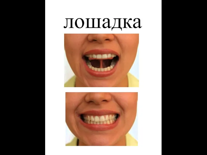 лошадка