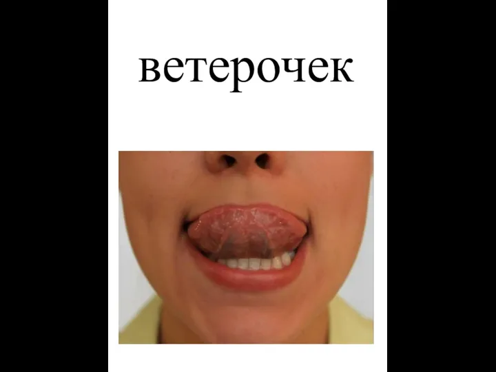 ветерочек