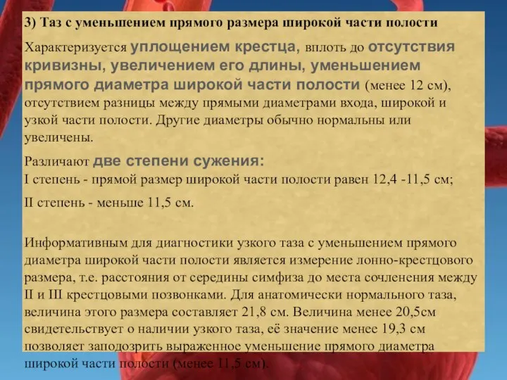 3) Таз с уменьшением прямого размера широкой части полости Характеризуется уплощением крестца,