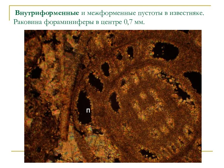 Внутриформенные и межформенные пустоты в известняке. Раковина фораминиферы в центре 0,7 мм. П