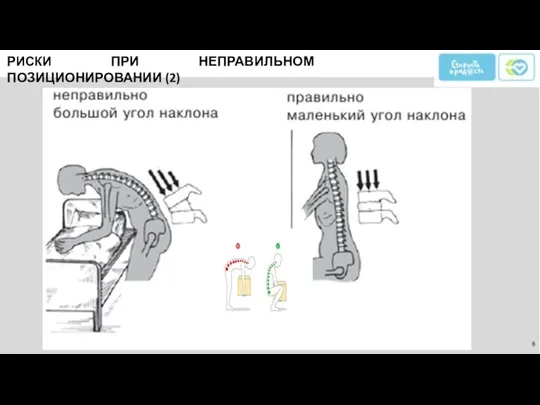 РИСКИ ПРИ НЕПРАВИЛЬНОМ ПОЗИЦИОНИРОВАНИИ (2)