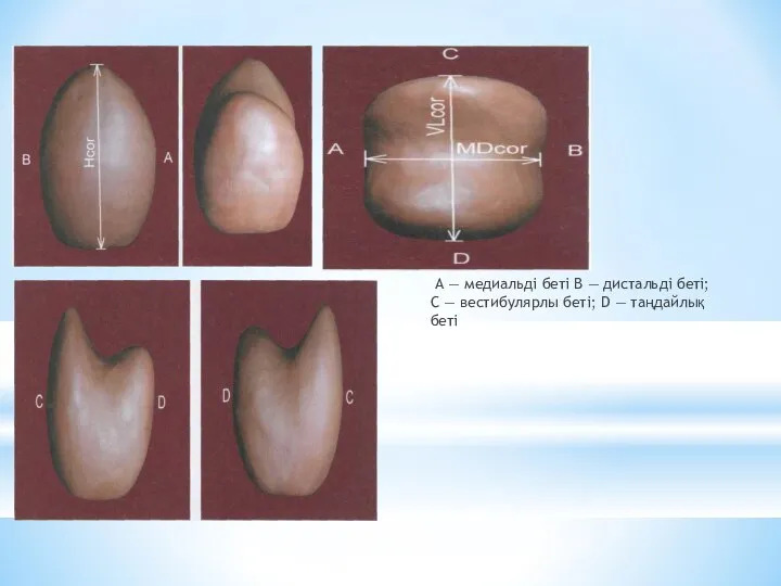 А — медиальді беті В — дистальді беті; С — вестибулярлы беті; D — таңдайлық беті