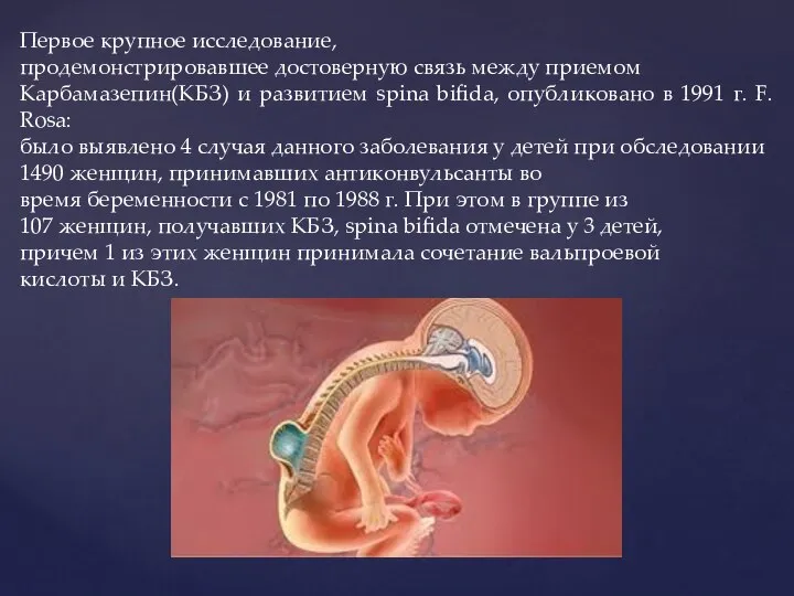 Первое крупное исследование, продемонстрировавшее достоверную связь между приемом Карбамазепин(КБЗ) и развитием spina