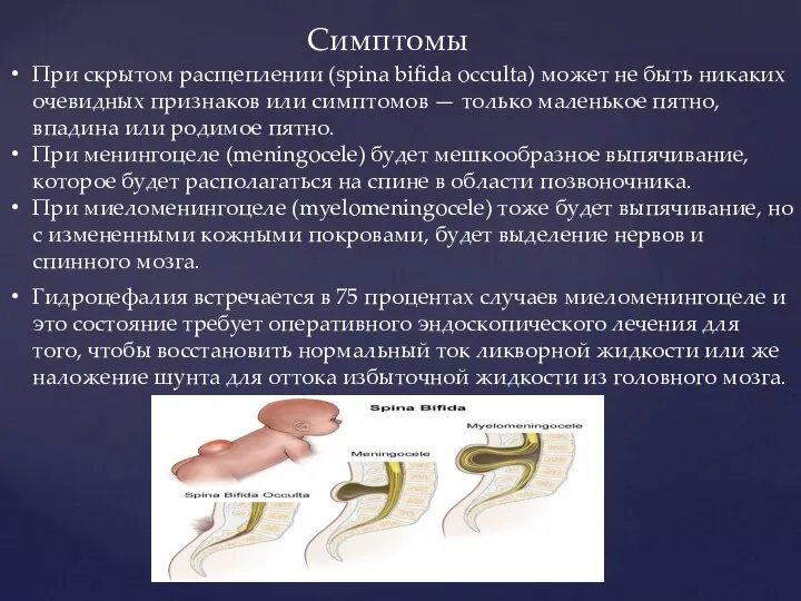 Симптомы При скрытом расщеплении (spina bifida occulta) может не быть никаких очевидных