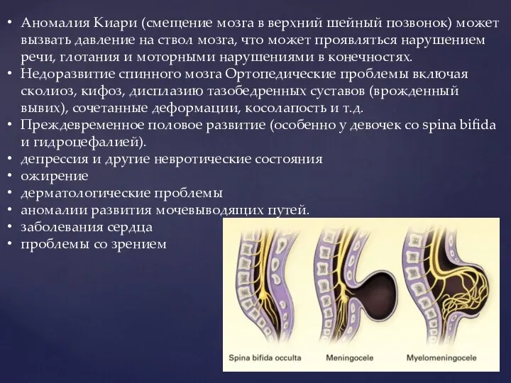 Аномалия Киари (смещение мозга в верхний шейный позвонок) может вызвать давление на