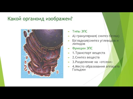 Какой органоид изображен? Типы ЭПС А) гранулярная( синтез белка) Б)гладкая(синтез углеводов и