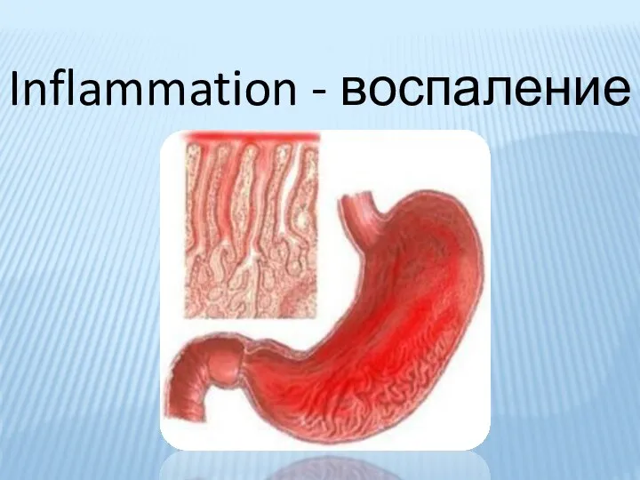 Inflammation - воспаление