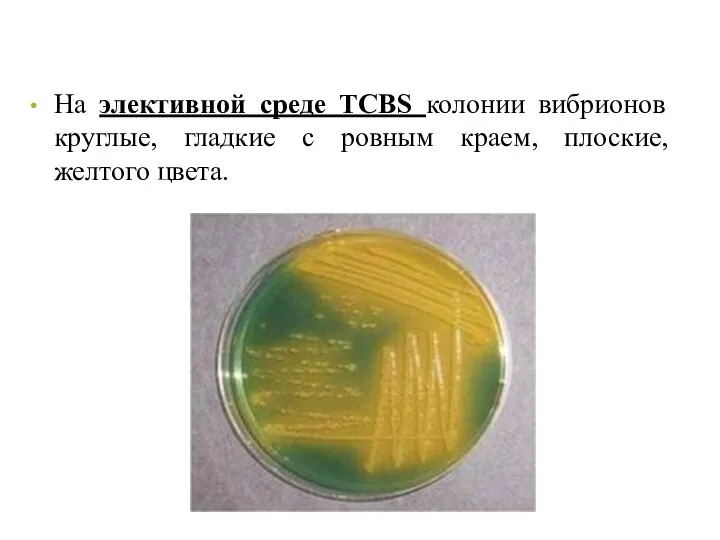 На элективной среде TCBS колонии вибрионов круглые, гладкие с ровным краем, плоские, желтого цвета.