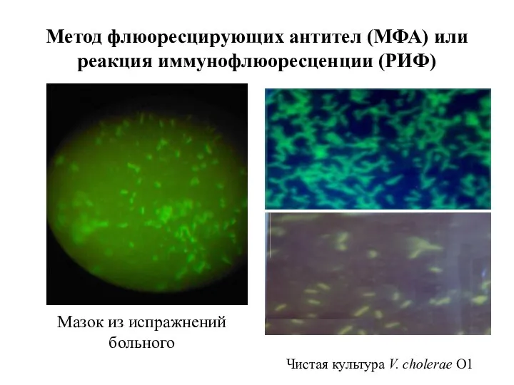 Метод флюоресцирующих антител (МФА) или реакция иммунофлюоресценции (РИФ) Мазок из испражнений больного