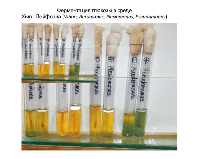 Ферментация глюкозы в среде Хью - Лейфсона (Vibrio, Aeromonas, Plesiomonas, Pseudomonas)