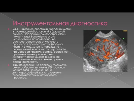 Инструментальная диагностика УЗИ – наиболее простой и доступный метод визуализации образований в