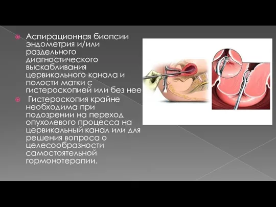Аспирационная биопсии эндометрия и/или раздельного диагностического выскабливания цервикального канала и полости матки