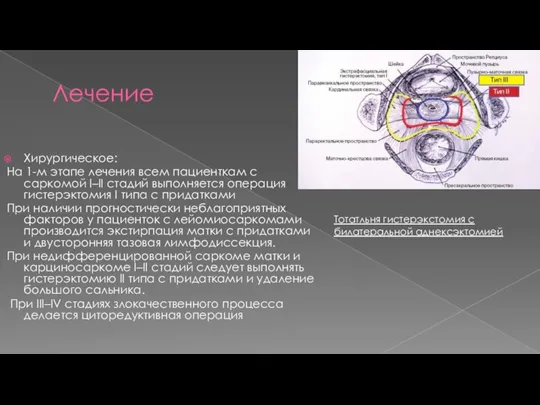 Лечение Хирургическое: На 1-м этапе лечения всем пациенткам с саркомой I–II стадий