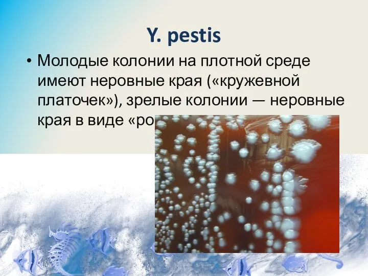 Y. pestis Молодые колонии на плотной среде имеют неровные края («кружевной платочек»),