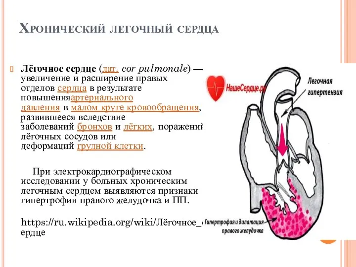 Хронический легочный сердца Лёгочное сердце (лат. cor pulmonale) — увеличение и расширение