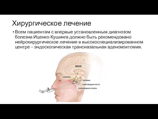 Хирургическое лечение Всем пациентам с впервые установленным диагнозом болезни Иценко-Кушинга должно быть