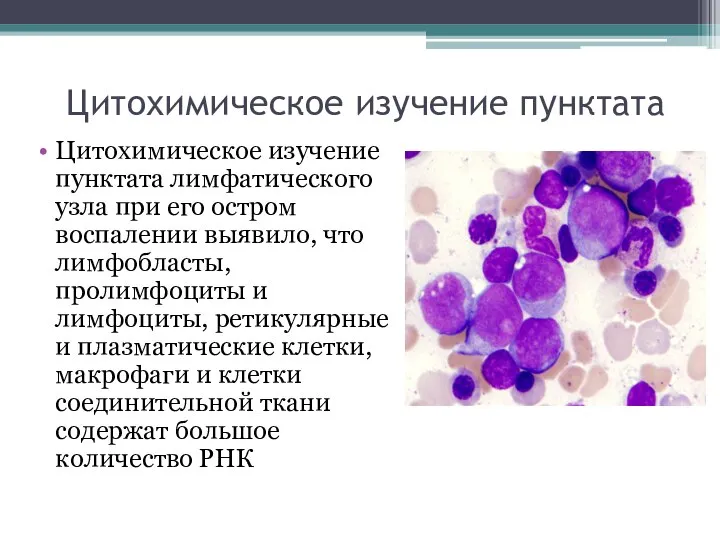 Цитохимическое изучение пунктата Цитохимическое изучение пунктата лимфатического узла при его остром воспалении