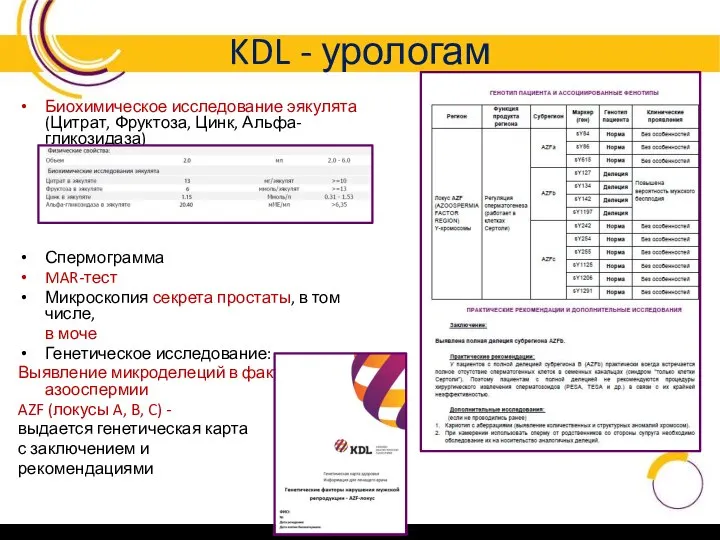 KDL - урологам Биохимическое исследование эякулята (Цитрат, Фруктоза, Цинк, Альфа-гликозидаза) Спермограмма MAR-тест