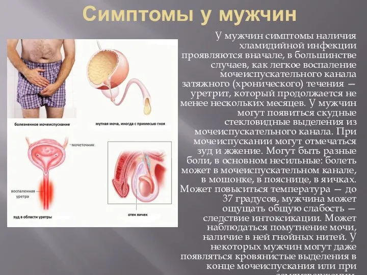 Симптомы у мужчин У мужчин симптомы наличия хламидийной инфекции проявляются вначале, в